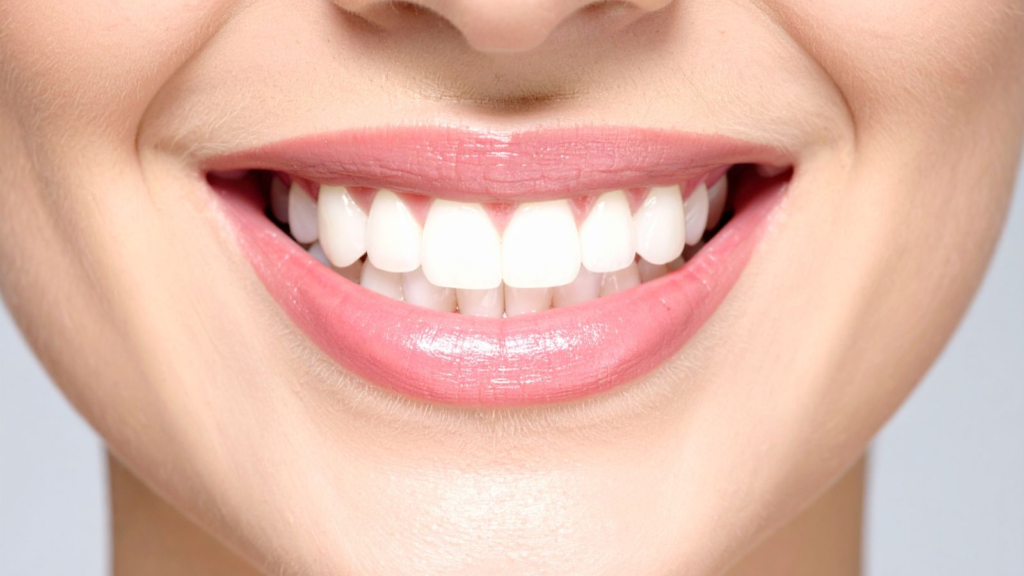 teeth whitening Offers in qatar 2026